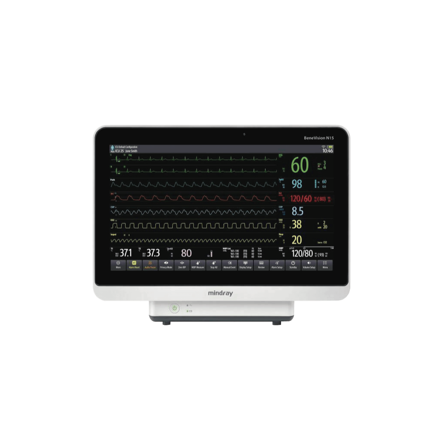 BeneVision N15